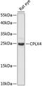 Complexin-4 antibody, 15-555, ProSci, Western Blot image 