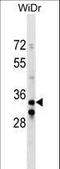 Integrin Subunit Beta 1 Binding Protein 2 antibody, LS-C159939, Lifespan Biosciences, Western Blot image 