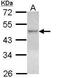LXR beta antibody, PA5-29771, Invitrogen Antibodies, Western Blot image 