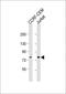 Mitochondrially Encoded NADH:Ubiquinone Oxidoreductase Core Subunit 5 antibody, GTX81641, GeneTex, Western Blot image 