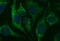 HSD17B4 antibody, M02923, Boster Biological Technology, Immunofluorescence image 