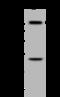 Histone-lysine N-methyltransferase SETD2 antibody, 203683-T32, Sino Biological, Western Blot image 