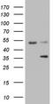 Galectin 9 antibody, TA805627S, Origene, Western Blot image 