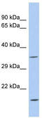 Aspartate Dehydrogenase Domain Containing antibody, TA335904, Origene, Western Blot image 