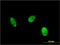 Exosome Component 1 antibody, H00051013-M01, Novus Biologicals, Immunocytochemistry image 