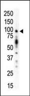 Protein Kinase D1 antibody, PA5-13749, Invitrogen Antibodies, Western Blot image 