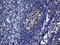 B-cell lymphoma 6 protein antibody, TA804243S, Origene, Immunohistochemistry paraffin image 