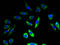 Calmodulin antibody, A58418-100, Epigentek, Immunofluorescence image 