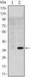Solute carrier family 22 member 1 antibody, abx011366, Abbexa, Enzyme Linked Immunosorbent Assay image 