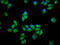 Protein Phosphatase 2 Regulatory Subunit B'Epsilon antibody, LS-C681109, Lifespan Biosciences, Immunofluorescence image 