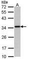 ROS Proto-Oncogene 1, Receptor Tyrosine Kinase antibody, orb13678, Biorbyt, Western Blot image 