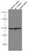 DEAD-Box Helicase 54 antibody, 66664-1-Ig, Proteintech Group, Western Blot image 