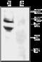 Amiloride-sensitive cation channel 3 antibody, GTX54807, GeneTex, Western Blot image 