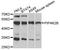 Phosphatidylinositol 4-Kinase Type 2 Beta antibody, A09390-1, Boster Biological Technology, Western Blot image 