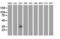 V-Set And Immunoglobulin Domain Containing 2 antibody, LS-C785390, Lifespan Biosciences, Western Blot image 