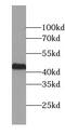 Zinc Finger Protein 385D antibody, FNab09692, FineTest, Western Blot image 