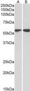 Vasodilator Stimulated Phosphoprotein antibody, TA348941, Origene, Western Blot image 