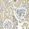 Ornithine decarboxylase antizyme 1 antibody, 22-944, ProSci, Immunohistochemistry paraffin image 