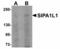 Signal Induced Proliferation Associated 1 Like 1 antibody, LS-B5053, Lifespan Biosciences, Western Blot image 