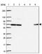 DDB1 And CUL4 Associated Factor 17 antibody, PA5-62779, Invitrogen Antibodies, Western Blot image 