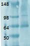 Solute Carrier Family 5 Member 5 antibody, orb67479, Biorbyt, Western Blot image 