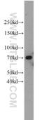 Ubiquilin 2 antibody, 23449-1-AP, Proteintech Group, Western Blot image 