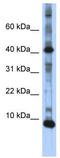 LSM6 Homolog, U6 Small Nuclear RNA And MRNA Degradation Associated antibody, TA343774, Origene, Western Blot image 