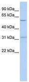 Nucleus Accumbens Associated 1 antibody, TA337274, Origene, Western Blot image 