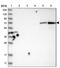 Hexosaminidase D antibody, NBP1-83575, Novus Biologicals, Western Blot image 