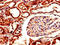 Aldo-Keto Reductase Family 1 Member A1 antibody, LS-C498341, Lifespan Biosciences, Immunohistochemistry paraffin image 