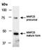 Matrix Metallopeptidase 25 antibody, orb67216, Biorbyt, Western Blot image 