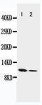 Resistin antibody, PA1473, Boster Biological Technology, Western Blot image 