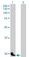 Pregnancy Specific Beta-1-Glycoprotein 11 antibody, H00005680-B01P, Novus Biologicals, Western Blot image 