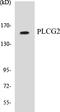 Phospholipase C Gamma 2 antibody, EKC1474, Boster Biological Technology, Western Blot image 