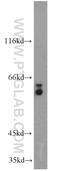 Proactivator polypeptide antibody, 18397-1-AP, Proteintech Group, Western Blot image 