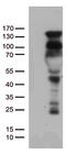 Progesterone Receptor antibody, UM800036, Origene, Western Blot image 