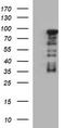 Forkhead Box P1 antibody, TA506701AM, Origene, Western Blot image 