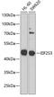Eukaryotic Translation Initiation Factor 2 Subunit Gamma antibody, GTX33173, GeneTex, Western Blot image 
