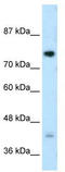 DC-STAMP Domain Containing 1 antibody, TA330510, Origene, Western Blot image 