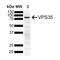 hVPS35 antibody, NBP2-78827, Novus Biologicals, Western Blot image 