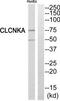 Chloride Voltage-Gated Channel Ka antibody, TA313630, Origene, Western Blot image 