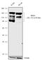 Bromodomain Containing 4 antibody, 702448, Invitrogen Antibodies, Western Blot image 