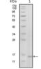 Ephrin type-B receptor 6 antibody, abx015741, Abbexa, Western Blot image 