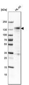 Myocardin Related Transcription Factor A antibody, AMAb91285, Atlas Antibodies, Western Blot image 