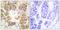 Collagen Type I Alpha 1 Chain antibody, SPC-1273D-P594, StressMarq, Immunocytochemistry image 