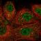 Semaphorin 3E antibody, HPA063804, Atlas Antibodies, Immunofluorescence image 