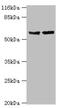 Cytochrome P450 Family 17 Subfamily A Member 1 antibody, A54704-100, Epigentek, Western Blot image 
