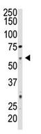 Ecto-5 -nucleotidase antibody, AP11873PU-N, Origene, Western Blot image 