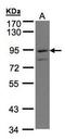 Prostaglandin F2 receptor negative regulator antibody, TA308947, Origene, Western Blot image 