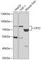 CPT2 antibody, GTX33117, GeneTex, Western Blot image 